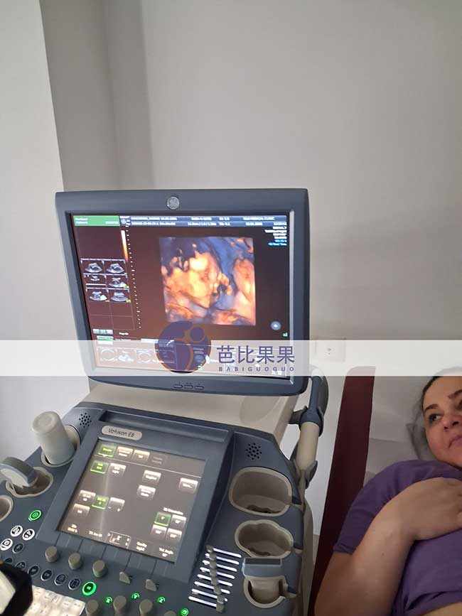 粱夫妇到格鲁吉亚匹配的试管妈妈做四维彩超圆满完成