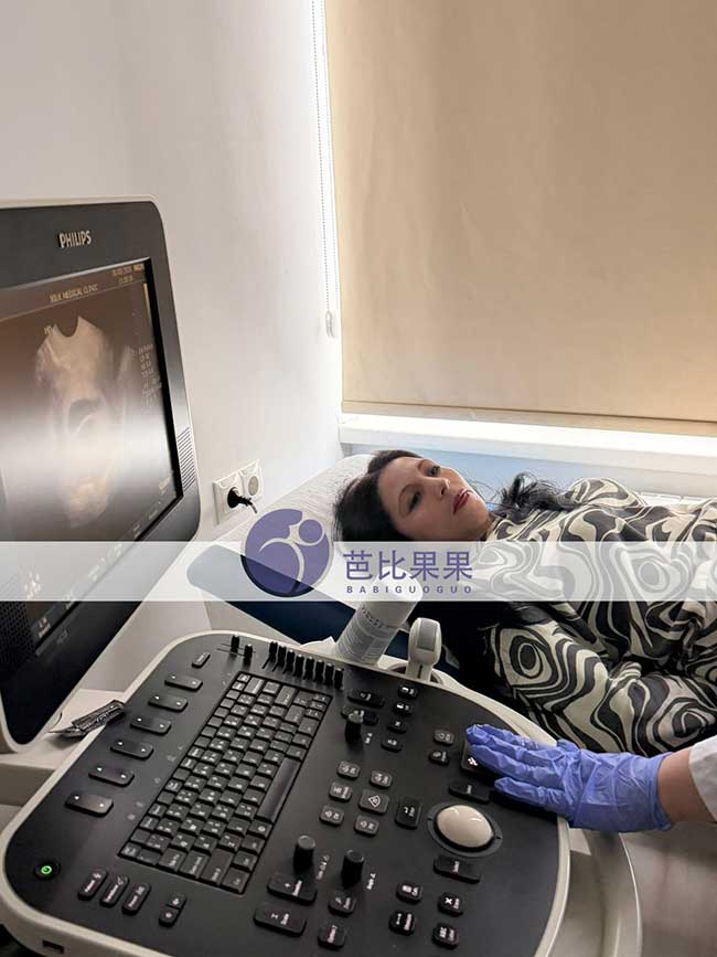 试管妈妈孕早期B超