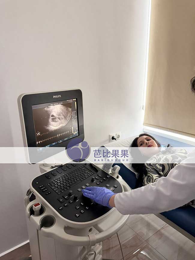 试管妈妈孕早期B超