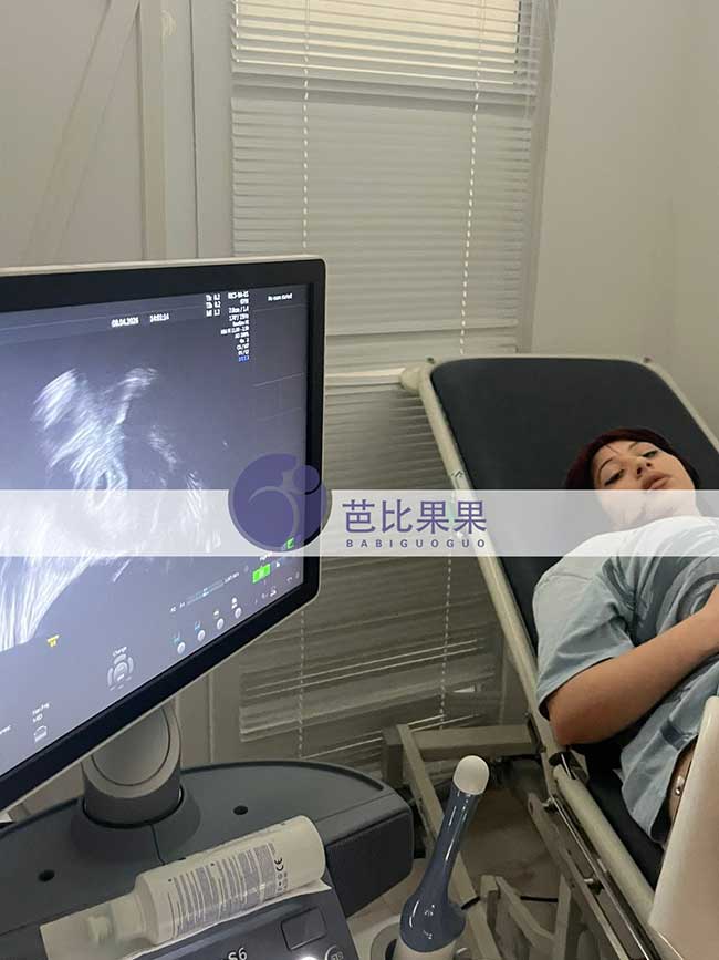 贺先生选格鲁吉亚全包试管套餐匹配的试管妈妈首次B超