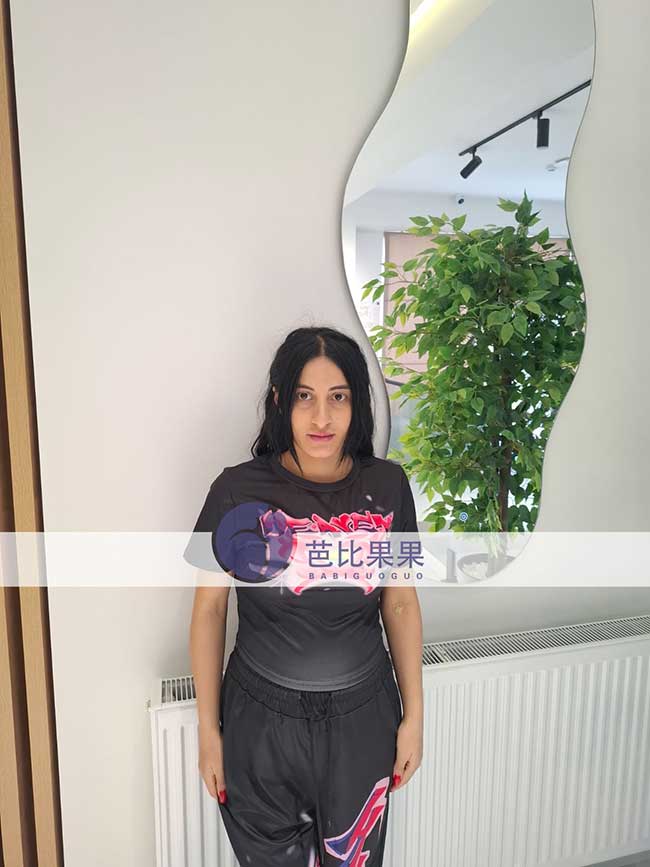 试管妈妈做四维彩超