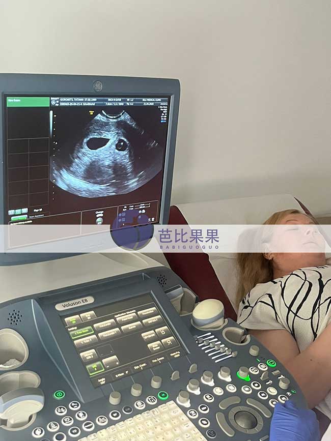 试管妈妈首次B超