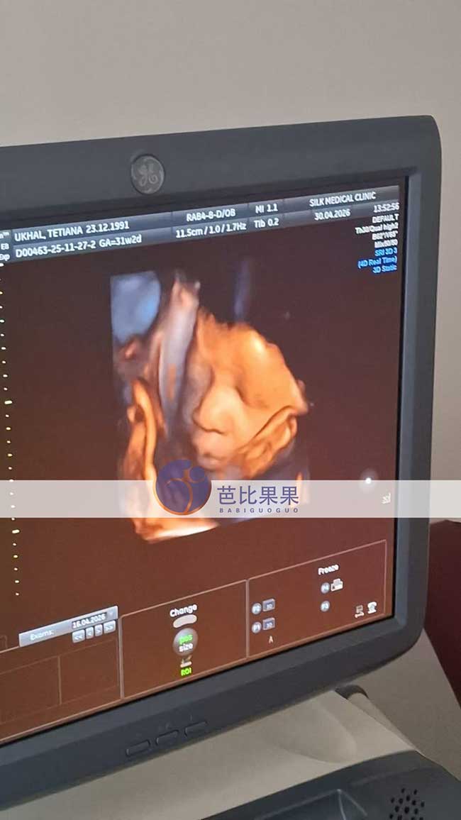 试管妈妈做B超