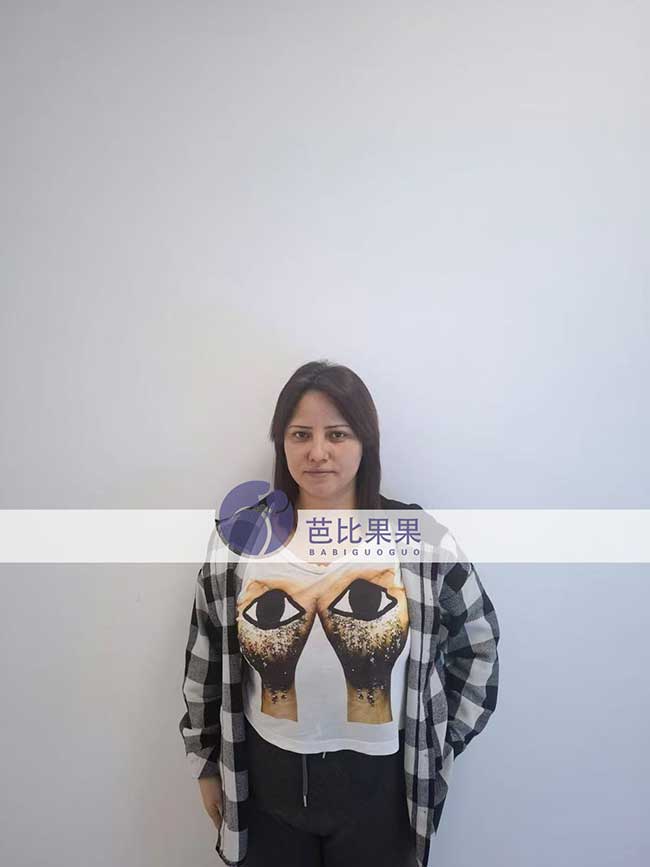 试管妈妈做B超