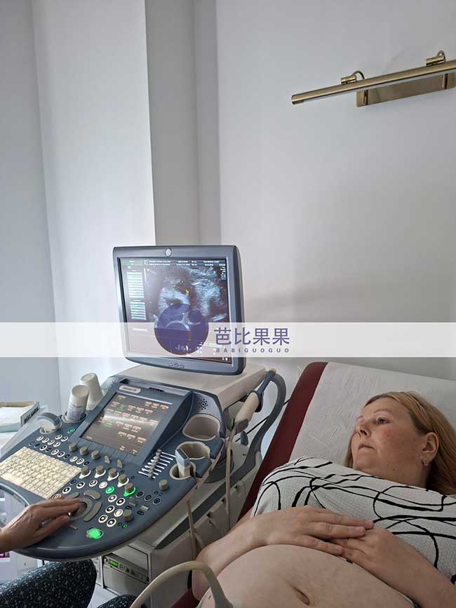 格鲁吉亚好孕跟进，陈先生匹配的试管妈妈准时来医院做B超检查