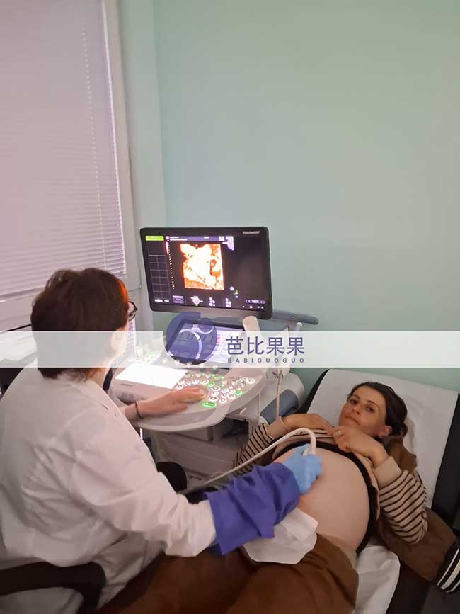 试管妈妈怀龙凤胎做四维彩超