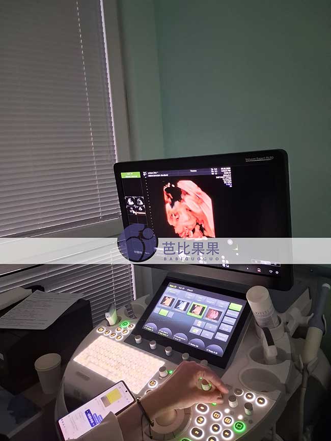 试管妈妈怀龙凤胎做四维彩超