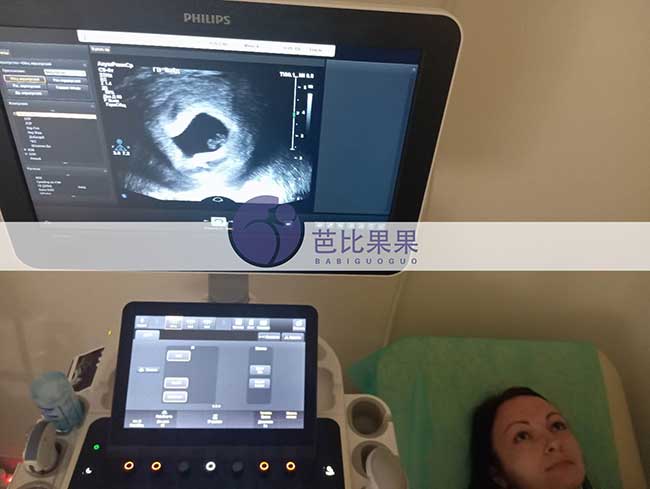 试管妈妈做B超