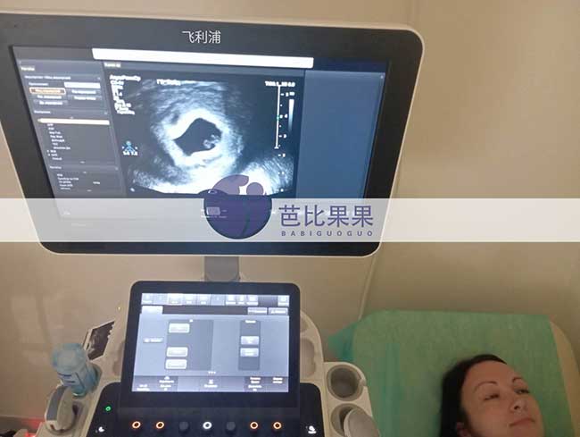 试管妈妈做B超