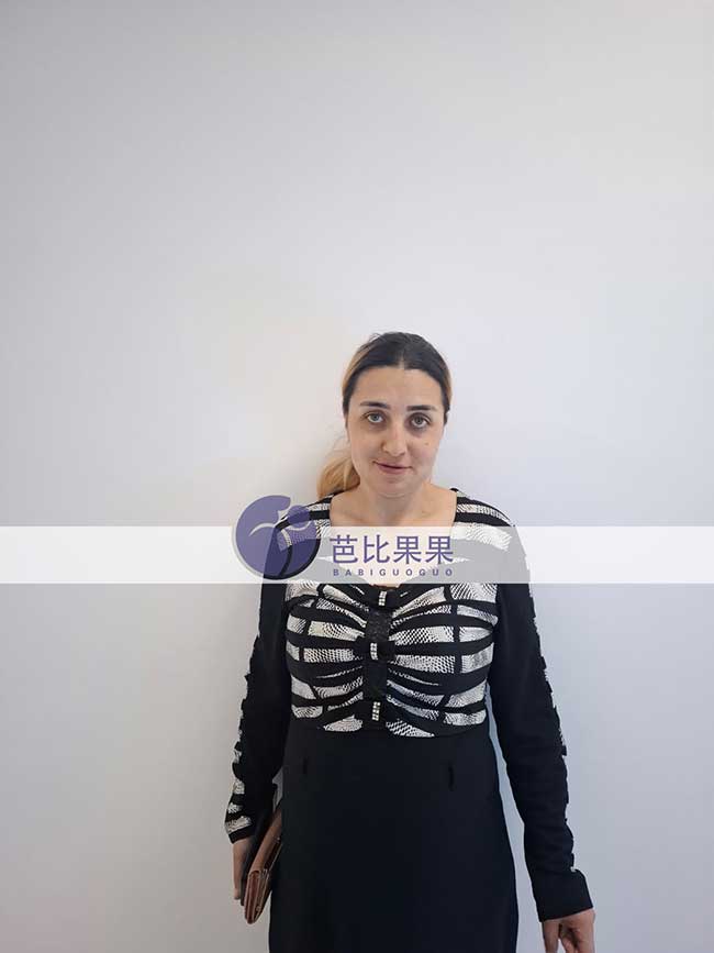 格鲁吉亚试管孕期进展更新：孔先生家庭B超复查顺利通过
