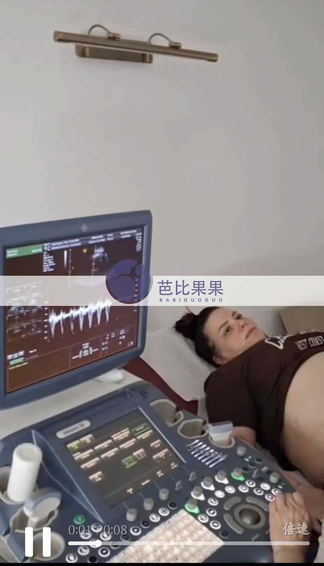 试管妈妈做B超