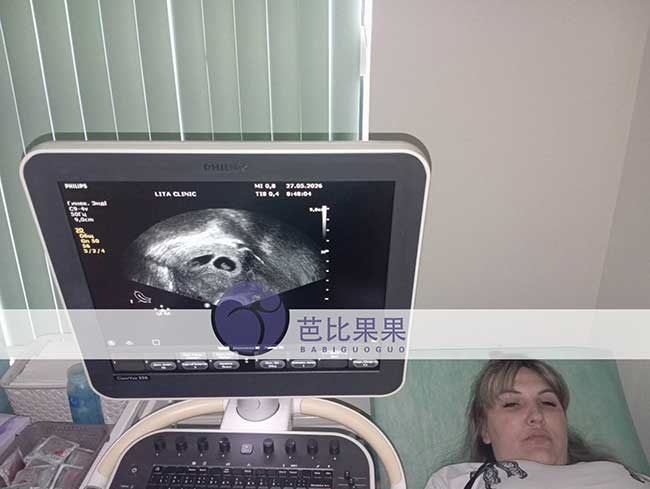 试管妈妈做B超