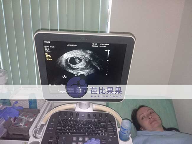 试管妈妈做B超