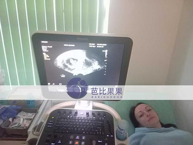 试管妈妈做B超