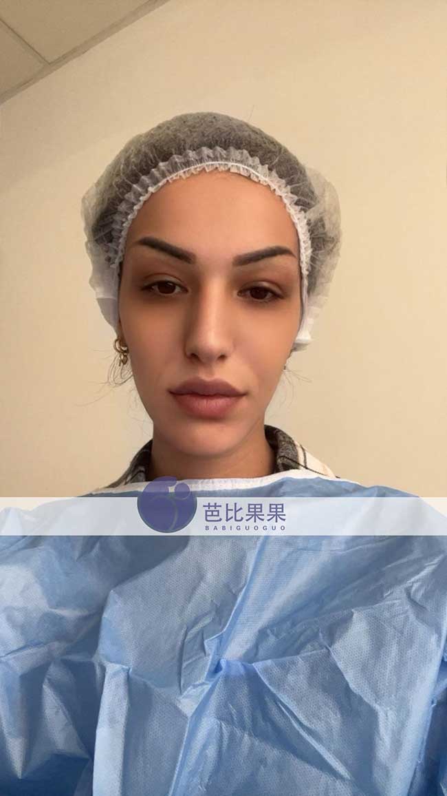 试管妈妈移植胚胎