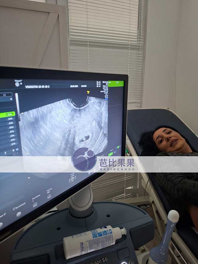 格鲁吉亚试管李先生家庭首次B超顺利通过,成功确认宫内妊娠
