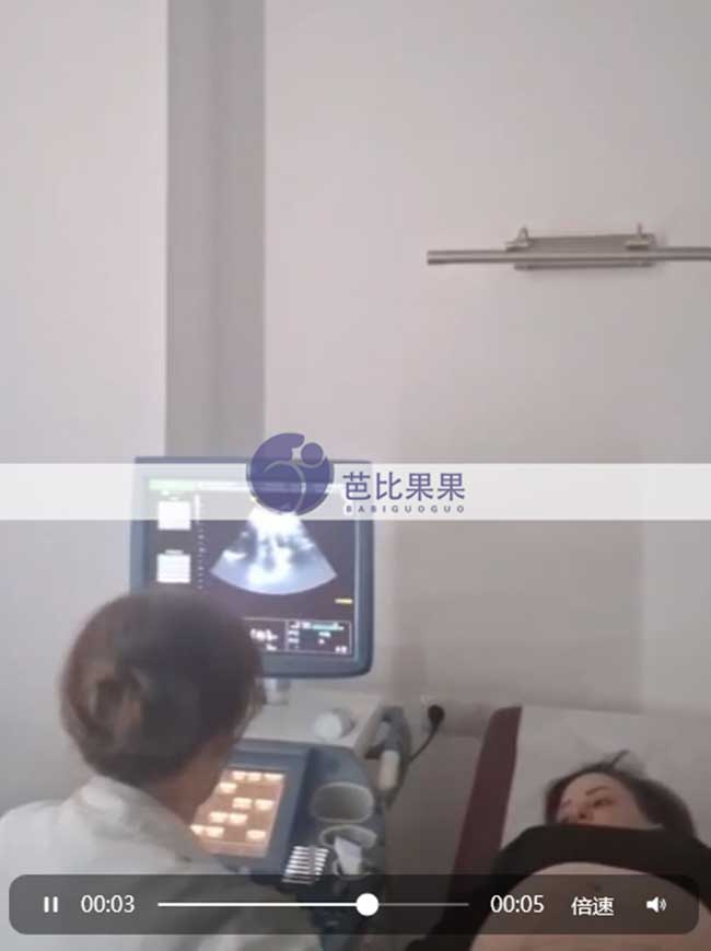试管妈妈做B超