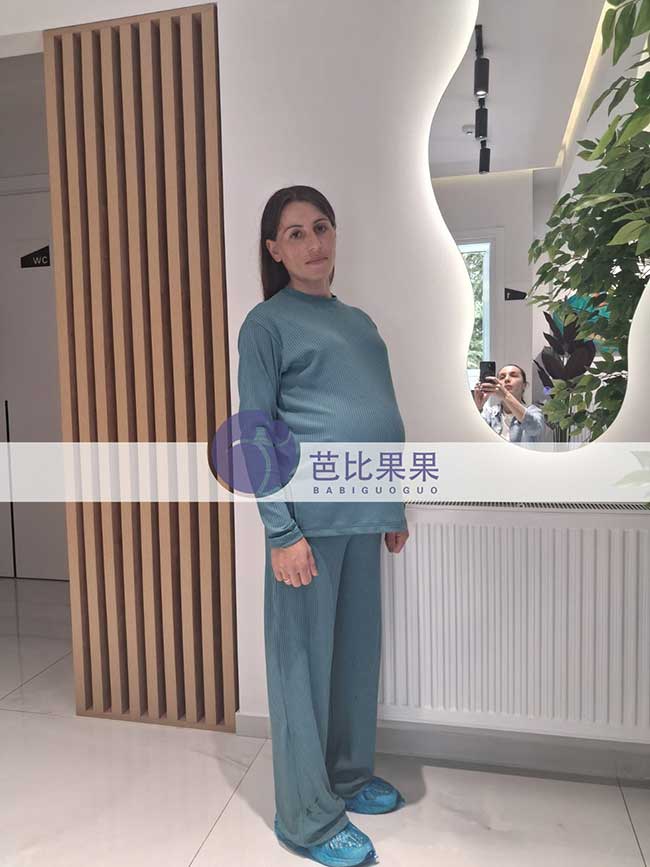 试管妈妈做四维彩超
