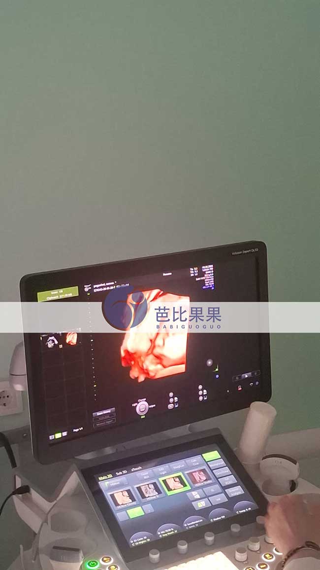 试管妈妈做B超