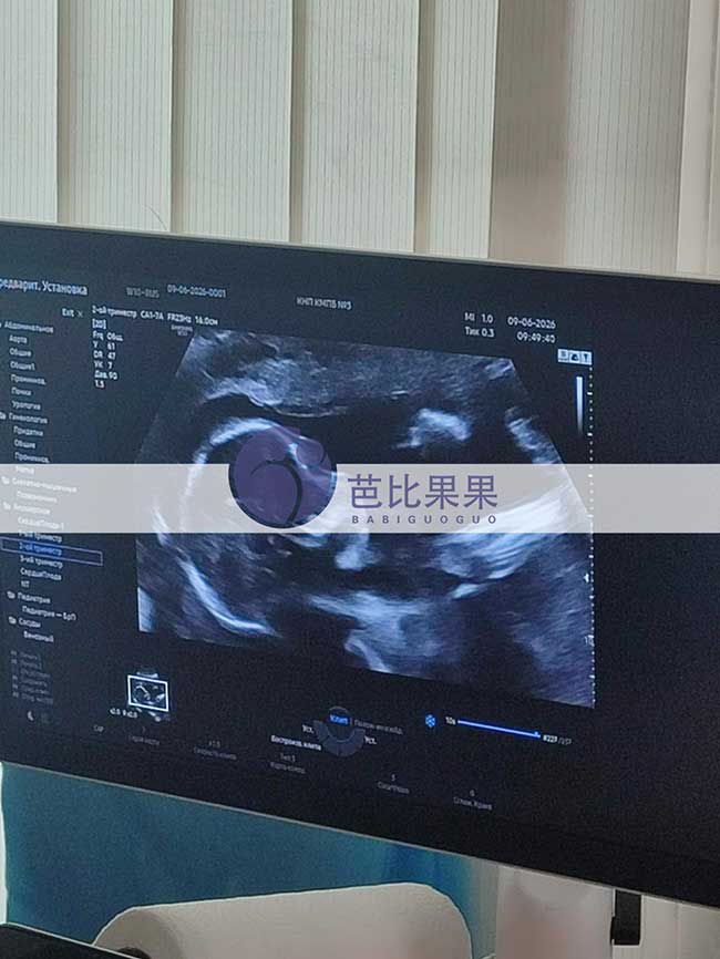 试管妈妈做B超