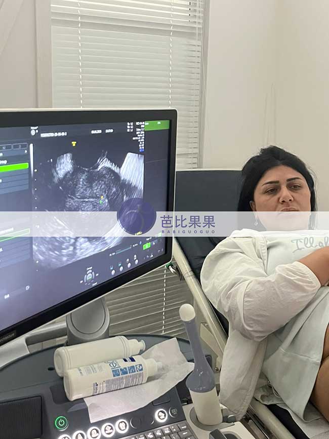 格鲁吉亚试管案例更新：陆先生夫妇孕8周B超顺利通过，胎心发育正常