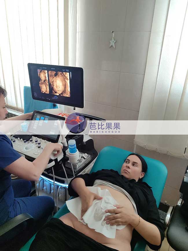 试管妈妈做四维彩超