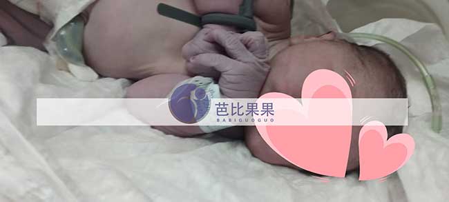 试管宝宝出生