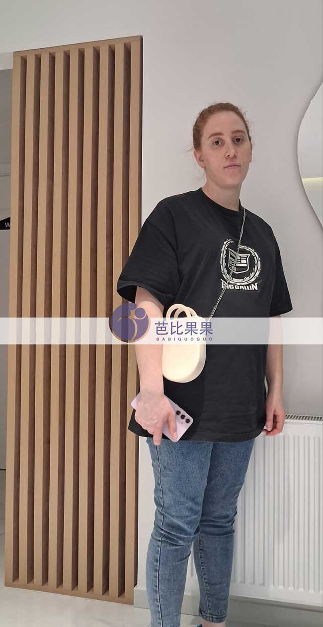 试管妈妈做四维彩超