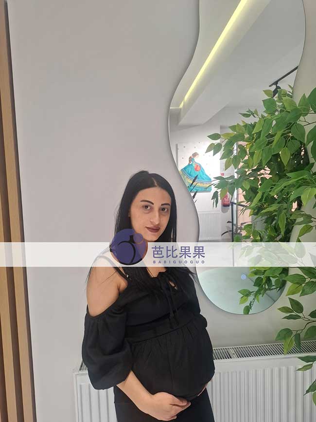 试管妈妈做四维彩超