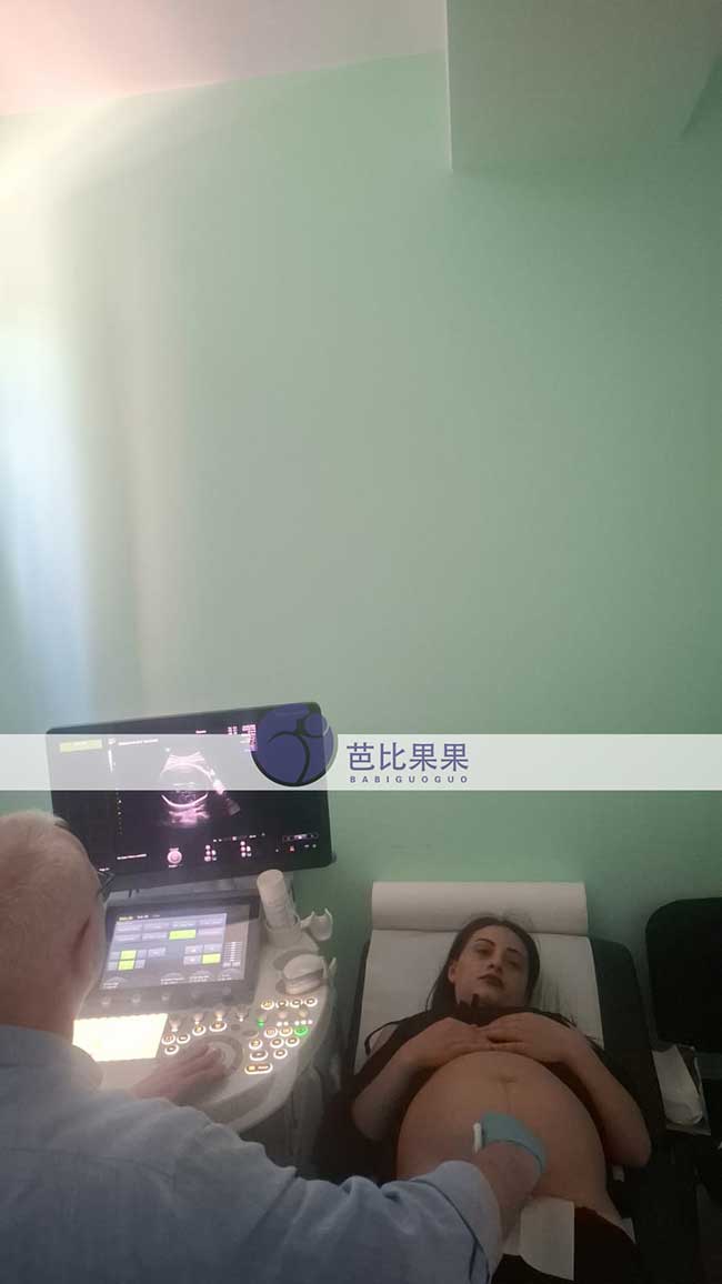 试管妈妈做四维彩超