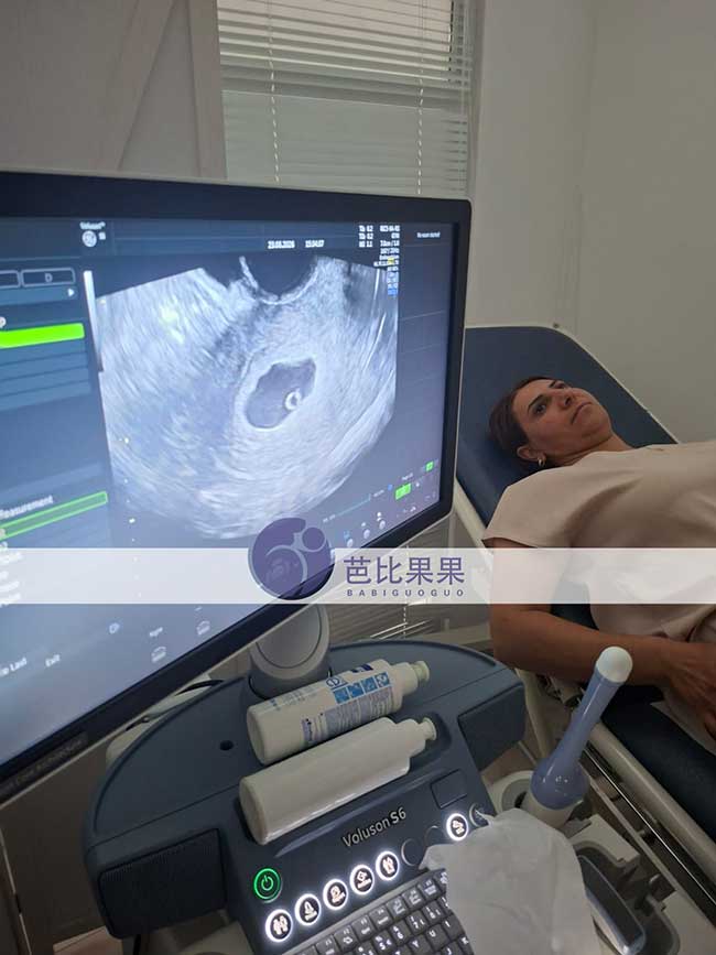试管妈妈首次B超