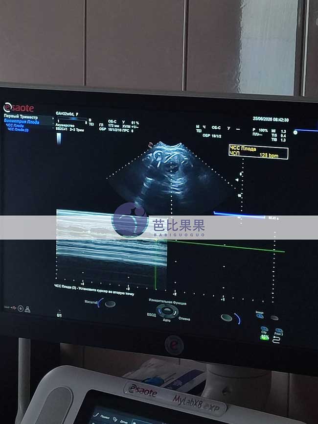 试管妈妈做孕检