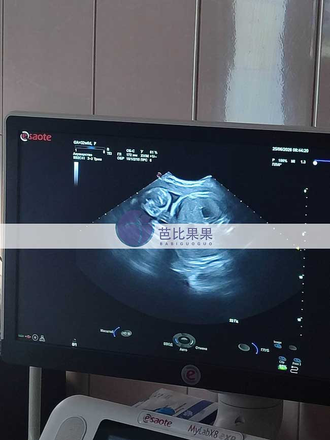 试管妈妈做孕检