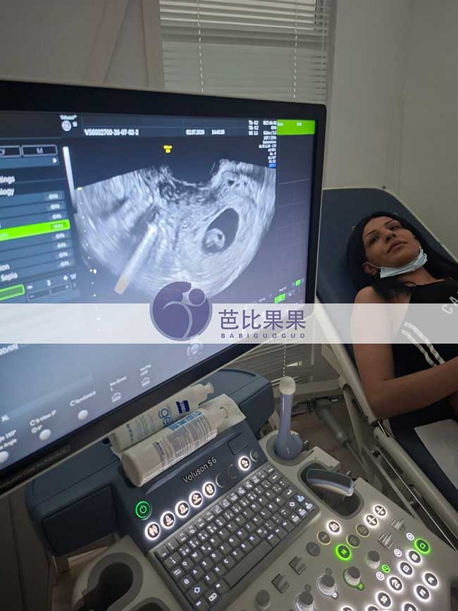 试管妈妈做B超