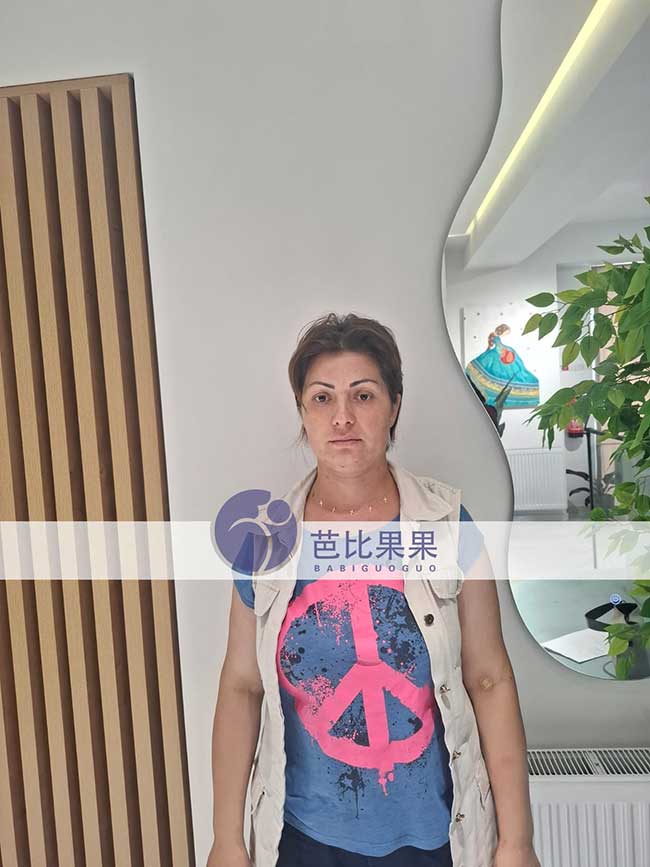 试管妈妈孕7周