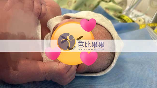 试管宝宝出生
