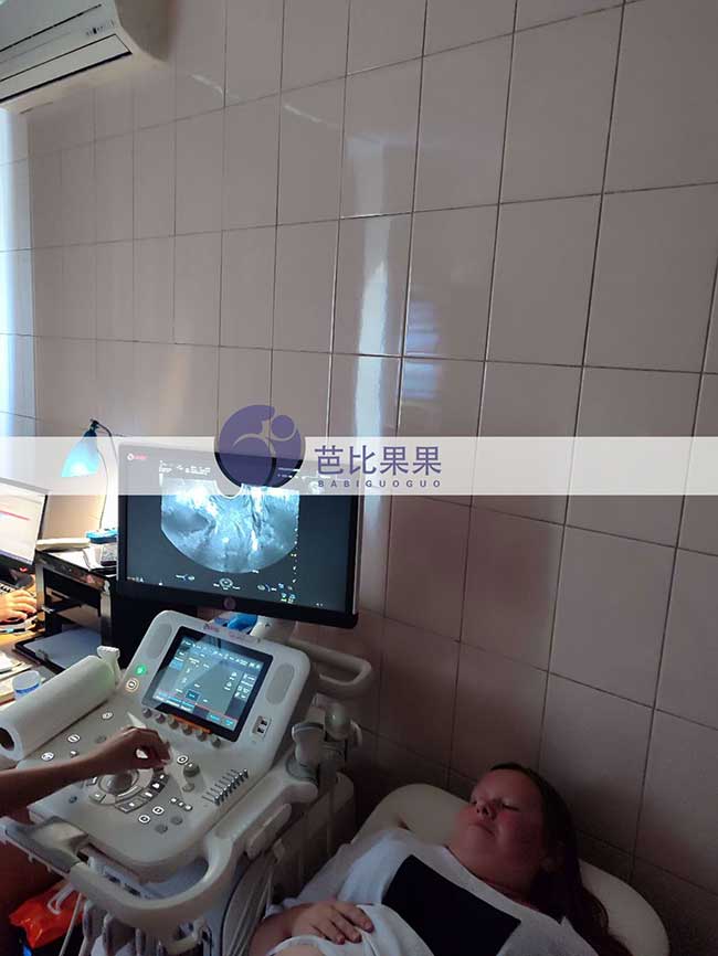 试管妈妈做B超