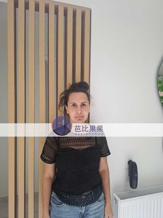 试管妈妈做B超