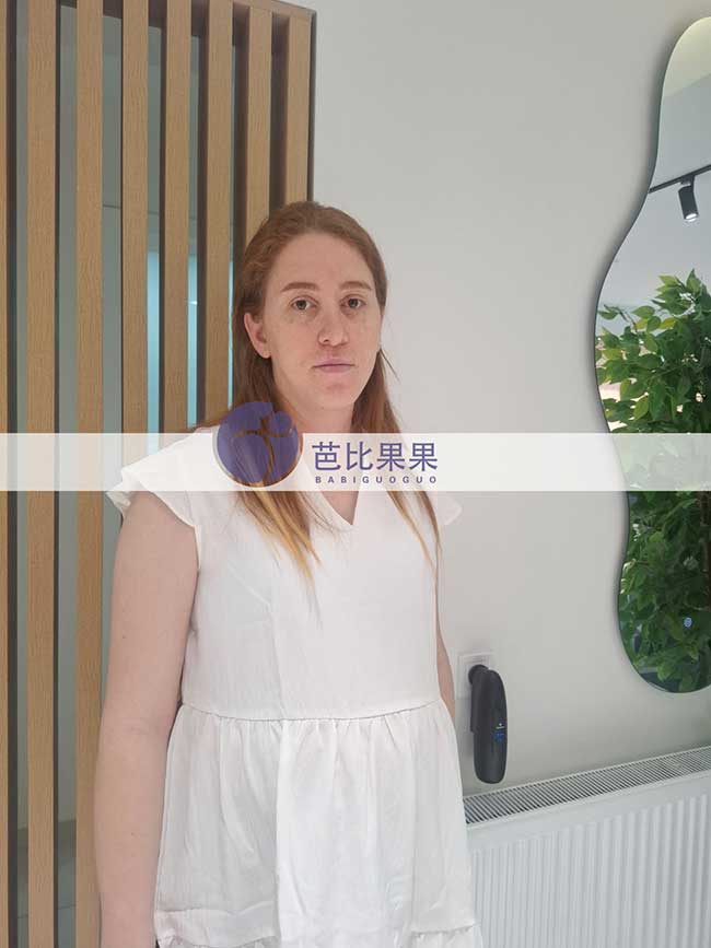 试管妈妈孕32周
