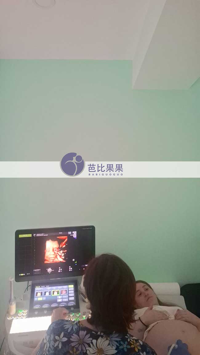 试管妈妈孕32周