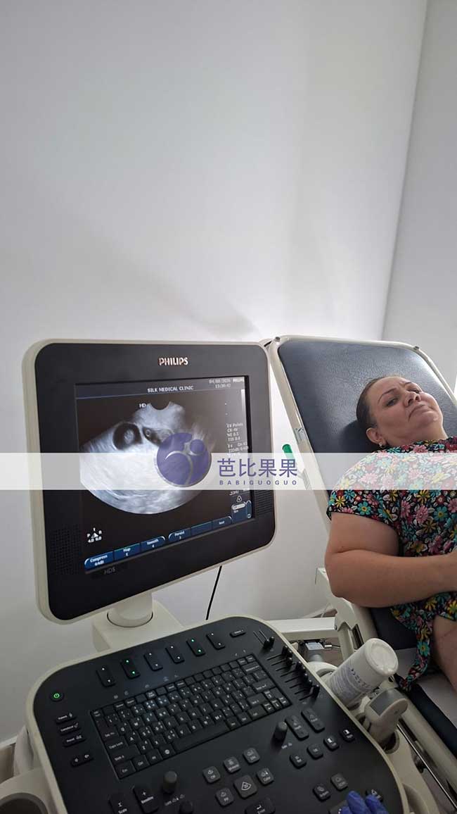 试管妈妈做B超