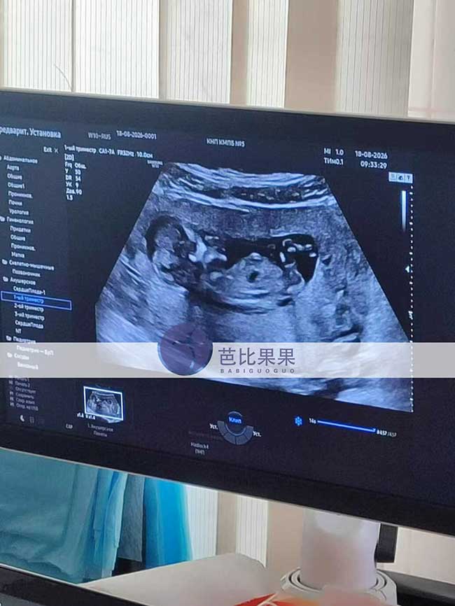 试管妈妈做B超
