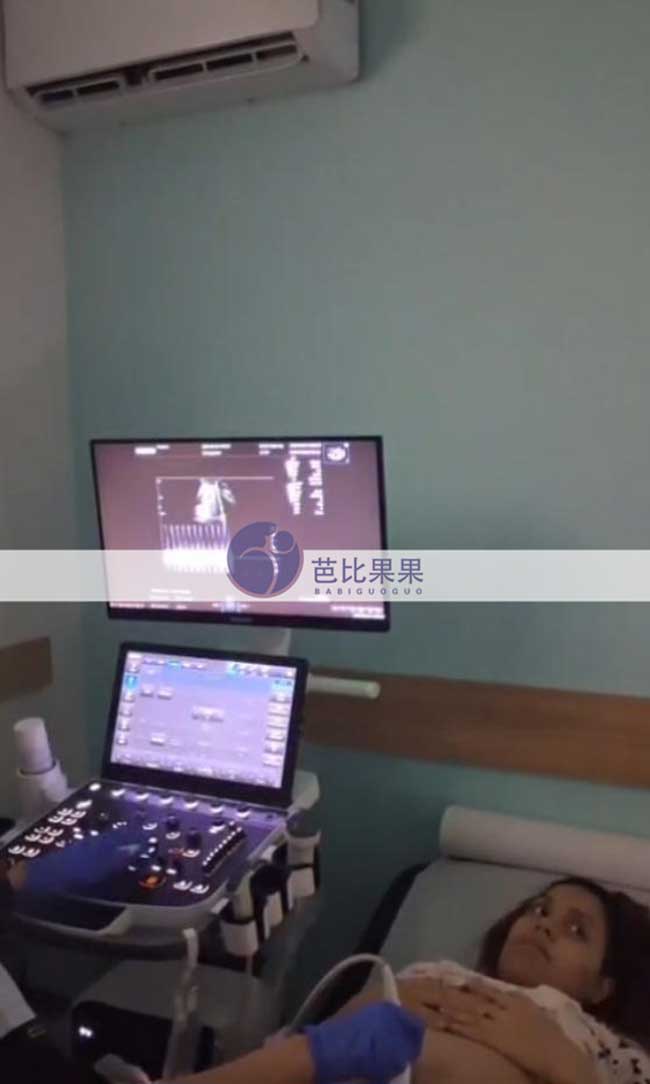 试管妈妈做B超