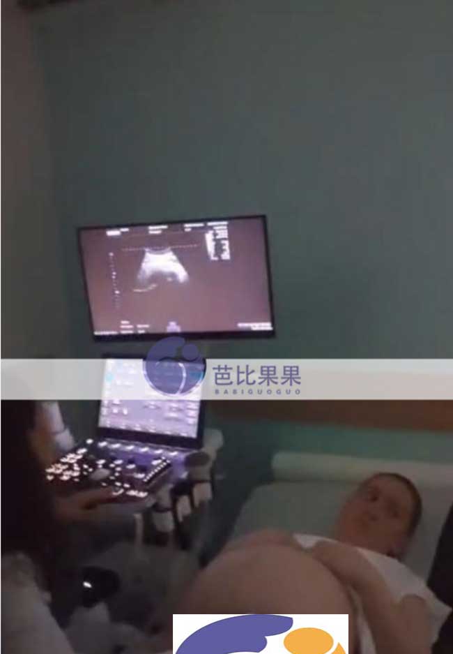 试管妈妈做B超