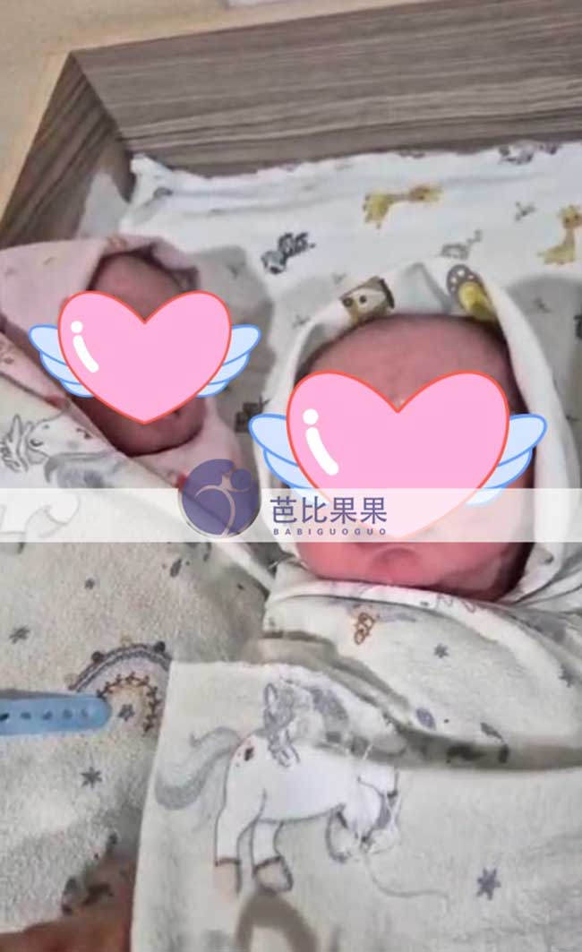 格鲁吉亚试管双胞胎出生