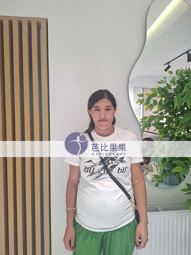 试管妈妈21周B超