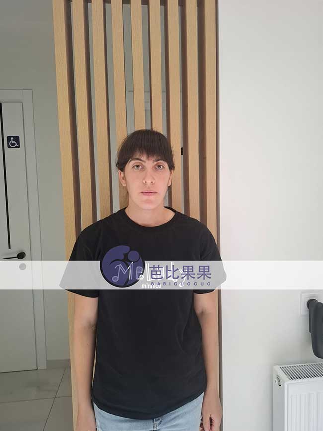 试管妈妈做B超