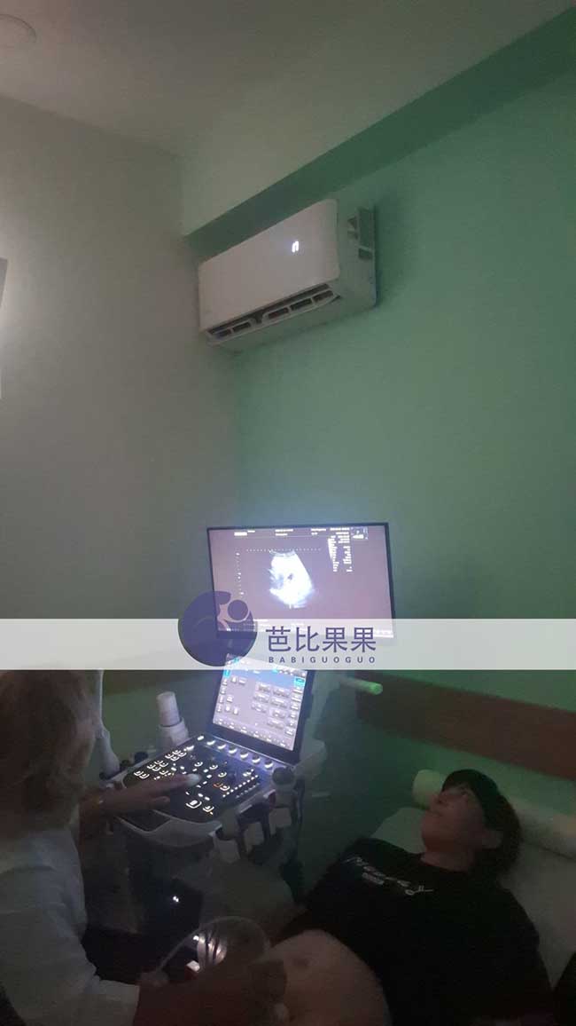 试管妈妈做B超