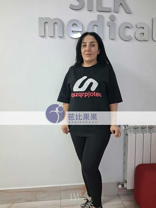 试管妈妈做B超