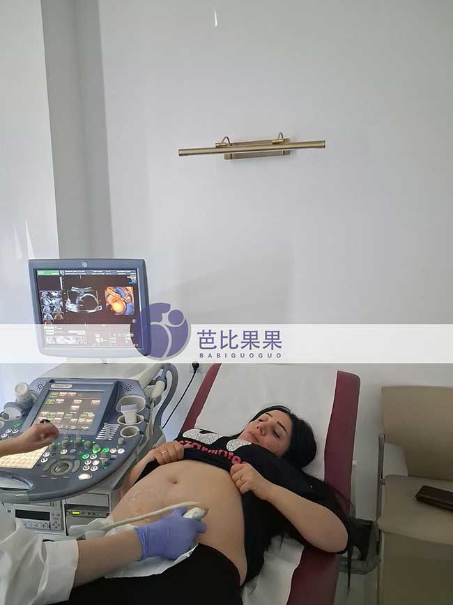 试管妈妈做B超